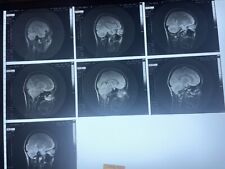 (7) Vintage X-Ray/MRI Photograph Human Skull Brain Medical 1980s picture