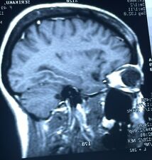 (11) Vintage X-Ray/MRI Photographs Human Skull Brain Medical 1990's picture