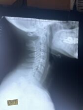 (15) Vintage X-Ray/MRI Photographs Human Skull Spine Ribs Medical 1960's picture