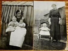 2) @1910 RPPC's/Real Photo Postcards Cleft Palate/Lip/Medical/Birth Defect Child picture